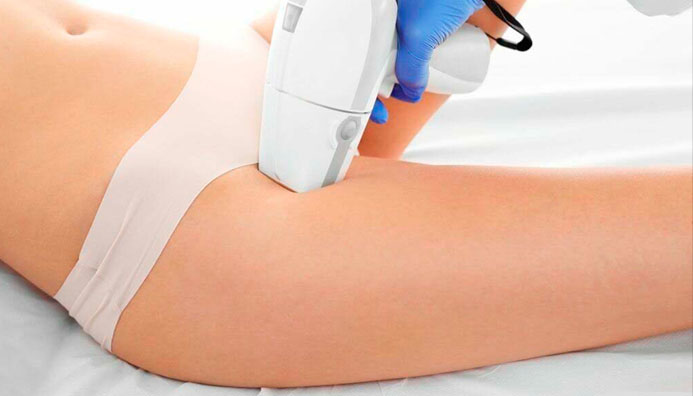 Curso Depilación Láser Definitiva